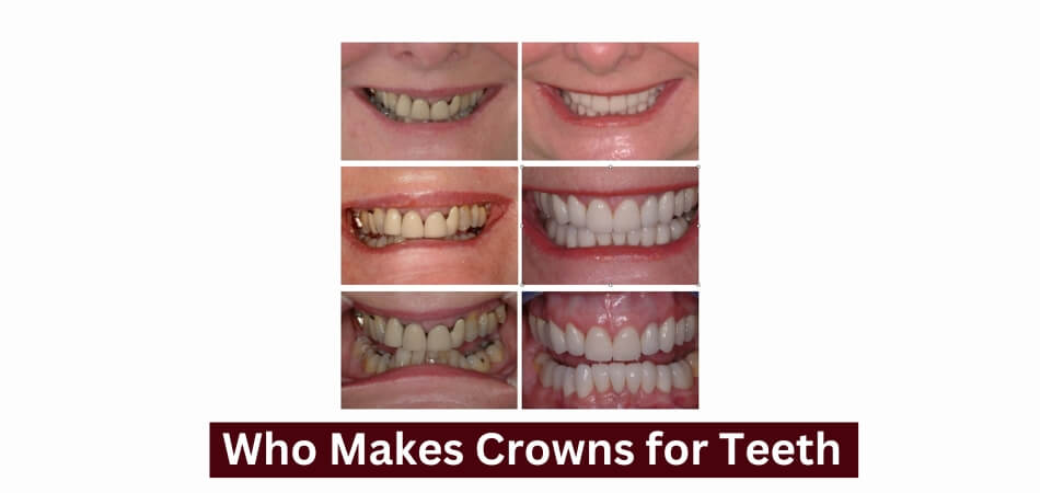 Who Makes Crowns for Teeth