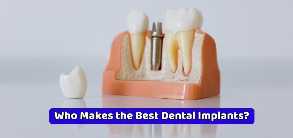 Who Makes the Best Dental Implants